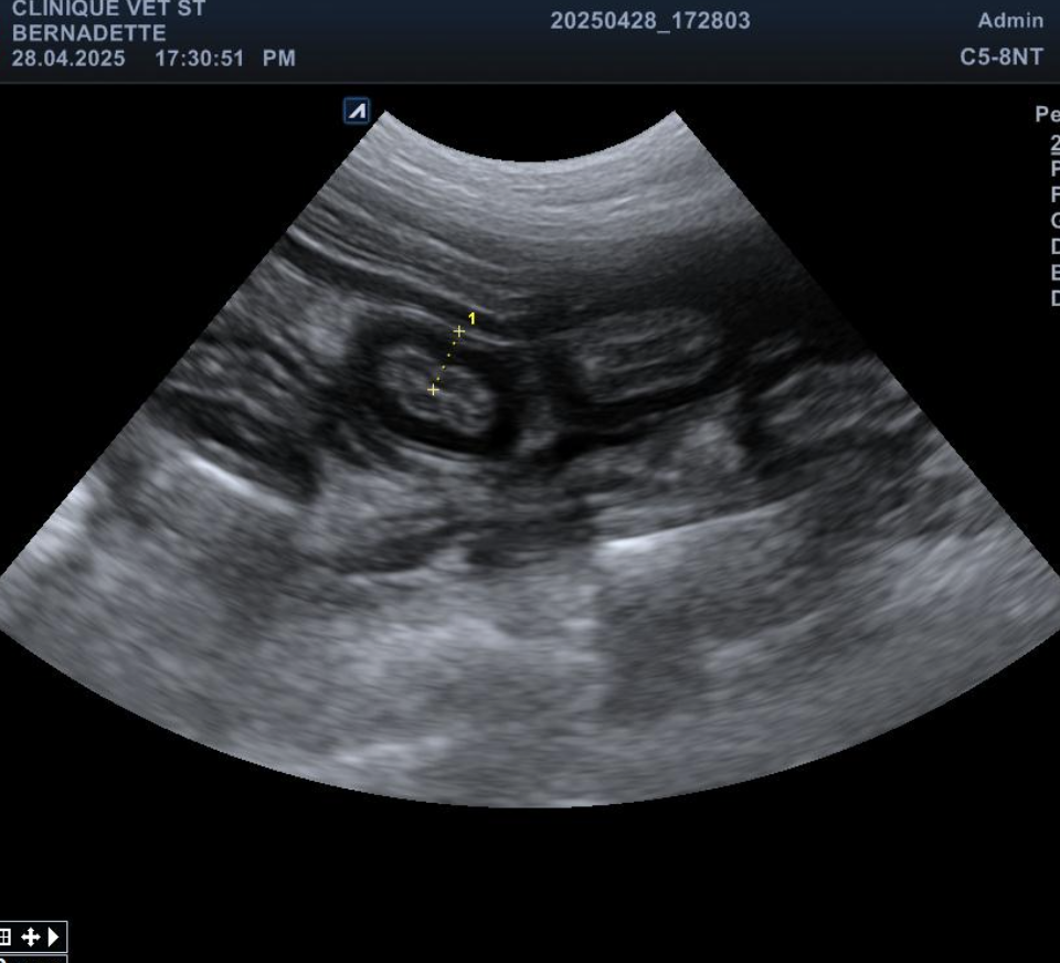 Echographie abdominale